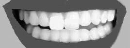 teeth that are abnormally placed or