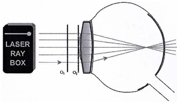 E22b Model of short-sighted eye (, transparency A) Display rays parallel intersect after passing through uncorrected eye lens at one point of the optical axis before the retina.