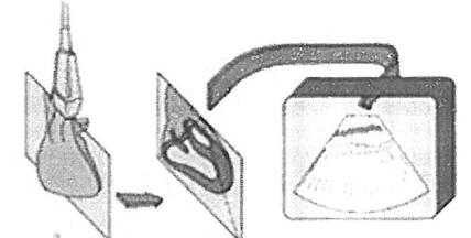 2 Transducer and piezoelectric crystal Ultrasound transducers use a piezoelectric crystal to produce and receive ultrasound waves (Figure 1).
