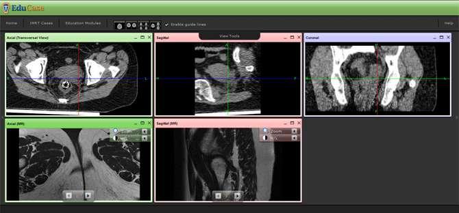 bottom row for Axial and Sagittal MR image sets.