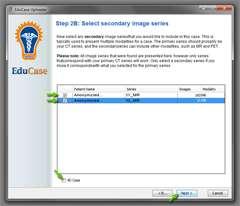 46 EduCase Uploader Tool supine * Select all the secondary image set you wish to upload with your case * Select the "4D Case"