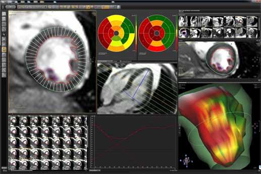 B The Breast MRI module allows for easy assessment of breast nodules due