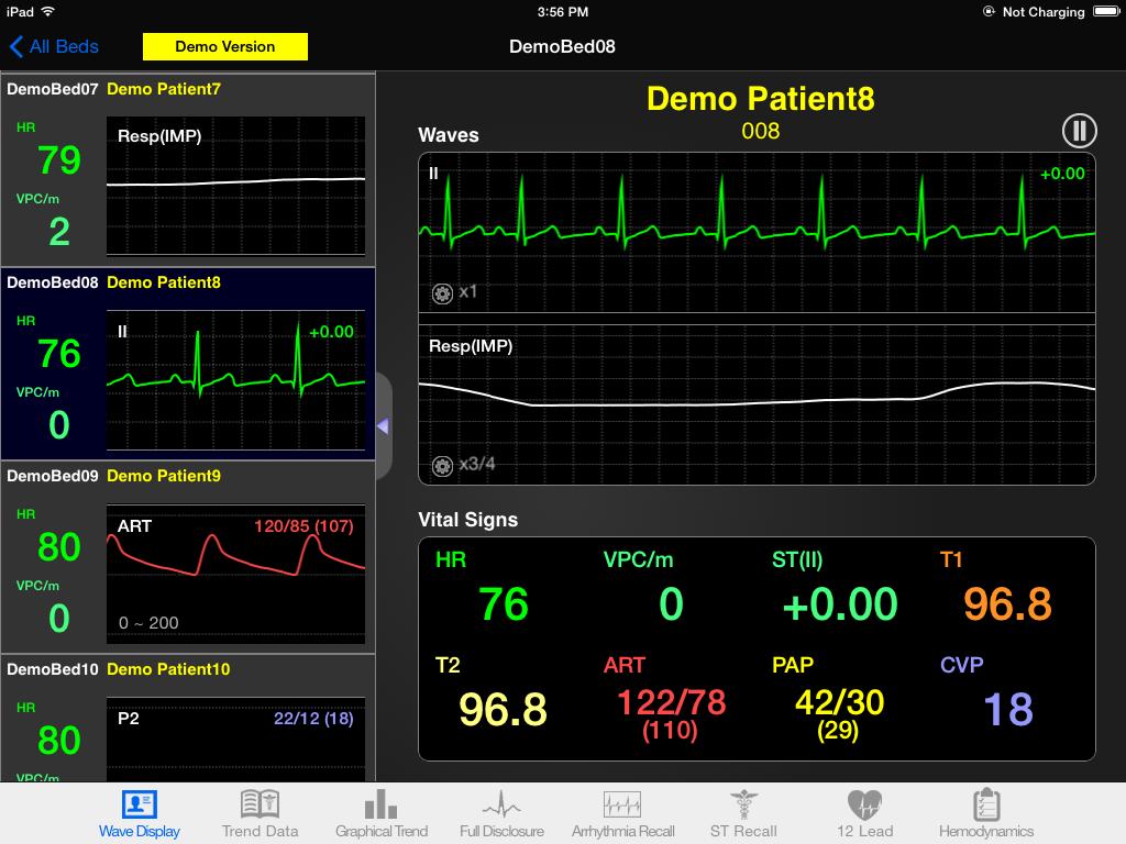 CAUTION There is a small latency associated in displaying numeric vital signs and waveform data on the mobile device. This latency is a factor of network load and the number of beds on the network.