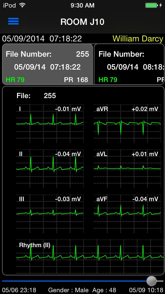 6.10 ST RECALL WINDOW The ST Recall window displays each ST Recall file s heart rate and the ST waveform and ST value for each lead. ipad iphone 6.