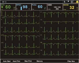 SpHb and PVI Capnography CO2: both mainstream and sidestream measurement possible Temperature 2 simultaneous measurements for core