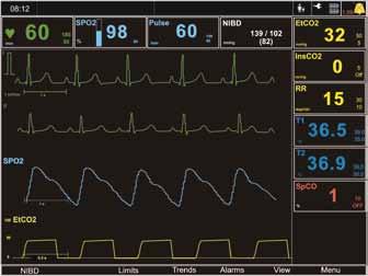 Diagnostics 12-channel ECG presentation on screen Resting ECG printout including measurement and interpretation Storage of recorded