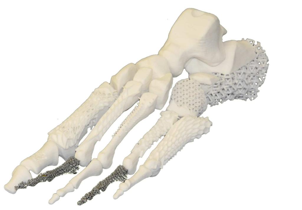 MODULES 6 Figure 1.3: A skeletal foot produced with different structures and materials 1.2 Modules In the 3S Generator, the structure is defined and structure cells are created.