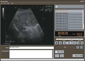 Newly Developed DVD+RW Disc for Medical Operations Sony has developed a new, highly reliable DVD+RW disc, the DPW120MD, tailored for the specific demands of medical recordings.