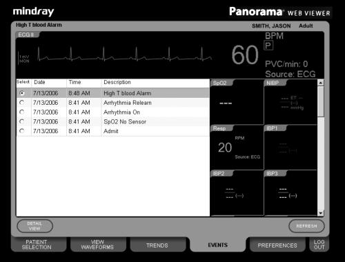Views Viewing Historical Data Event Description Heart Rate Tile ECG Waveform Area Event Parameters Event List FIGURE 2-
