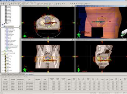 DICOM-RT interface TPS CT G4 Compare TPS dose distribution and Geant4 dose