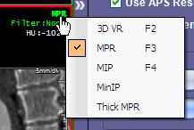 Mouse Functions Window/Level Left + Right (simultaneously) Click/hold and drag Rotate (for 3D VR) Left Click/hold and drag Page Slices Left Click/hold and drag up/down Zoom Scroll Wheel (middle)