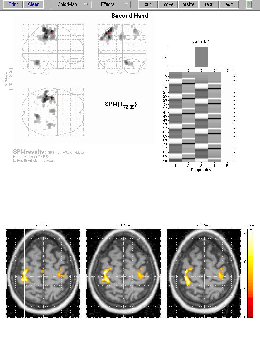 fmri on T1