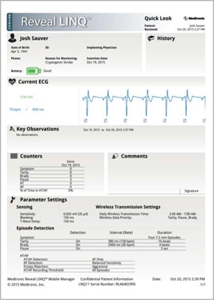 VIEW REPORTS Quick Look Report The Quick Look Report provides a basic overview of the Reveal LINQ ICM status and the patient s condition.