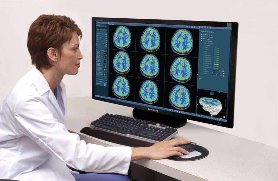 Optimized Workflow Automated Processing Provides Answers Faster and More Efficiently The DynaSuite Neuro Workstation is a high performance advanced MR Neuro solution for rapid and repeatable