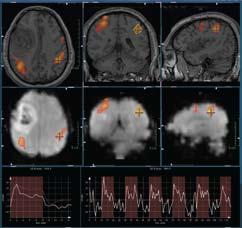 thresholds for fmri, perfusion and vessel analysis Versatile options for