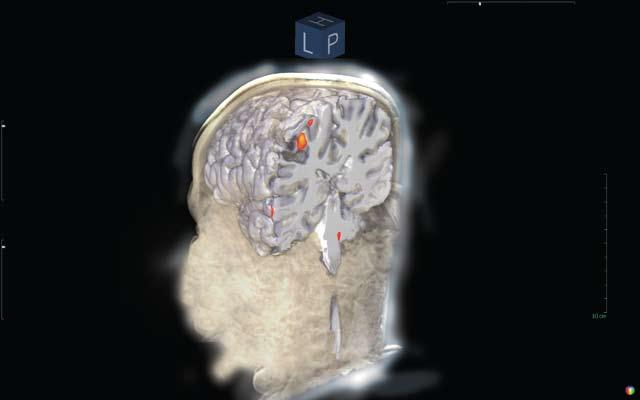 In addition, it provides visual inspection of fmri, and adjustment of 3D vessels, 3D cortex surface