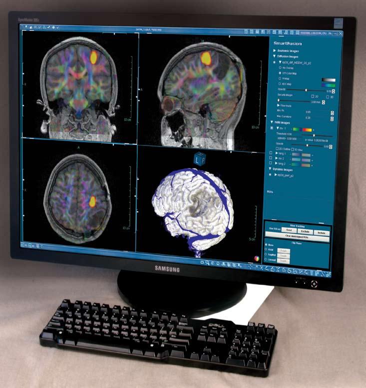DynaSuite Neuro DynaSuite Neuro is a comprehensive solution providing world class analysis, workflow, and fusion of MR images.