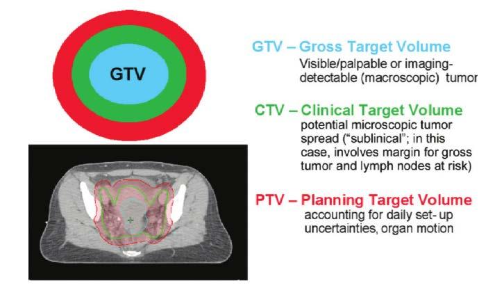 ICRU 50 Purpose: to promote the use of a common language for specifying and reporting the doses in radiation therapy, as well as the volumes in which they are prescribed GTV & CTV are purely