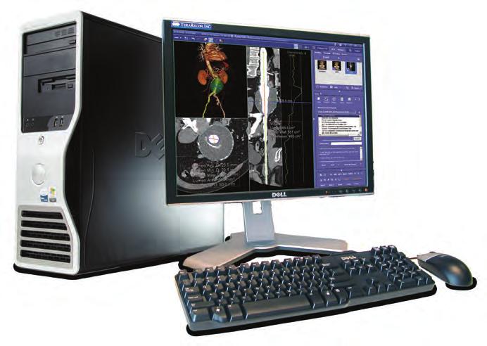 The SCENARIA SE combines enhanced ergonomics with Hitachi s improved workflow processes and technologies resulting in