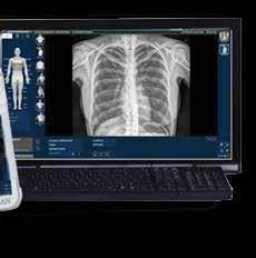 just a few quick steps Outstanding images at very low radiation dose come easily with LuminX Software Features Intuitive space-saving desktop workstation Image display in less than 3 seconds