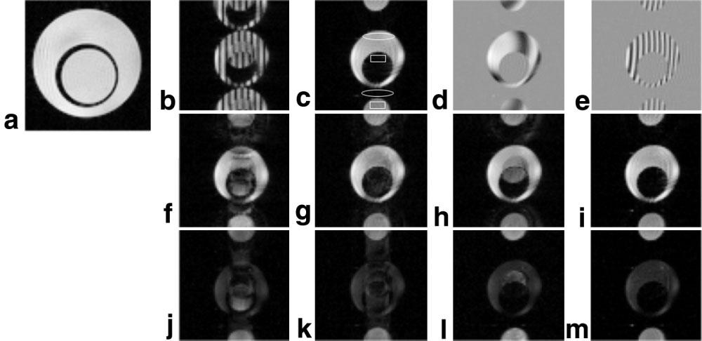 150 Chen and Wyrwicz FIG.. Removal of Nyquist artifacts in a two-component phantom EPI.