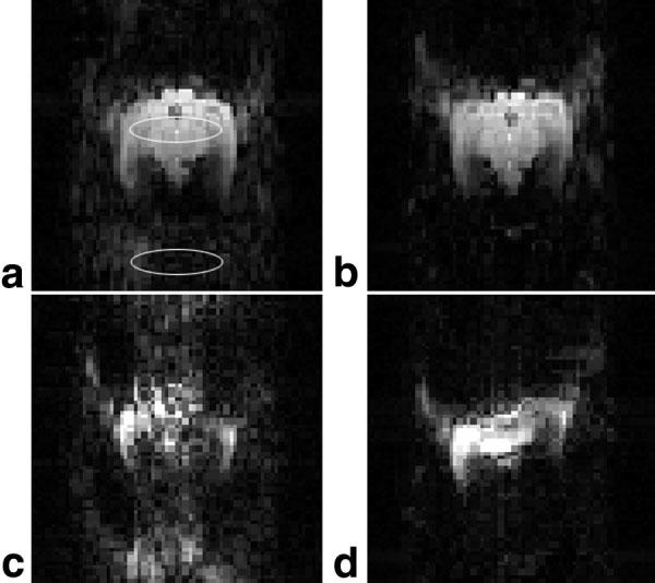 EPI Ghost Artifact Removal 151 Table 1 Ghost-to-Signal Ratios in Phantom EPI Images Processed With Different Ghost Artifact Removal Methods Diffusion gradient 0 1 Gauss/cm Method applied m1 m m3 m5