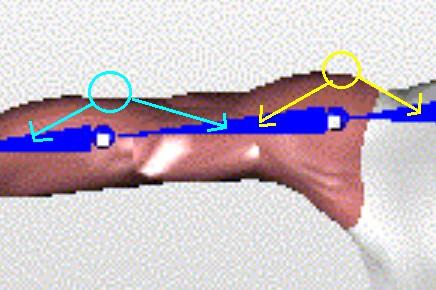 Problem : For some points, we don t know to which body segment it belongs to For the points near the elbow