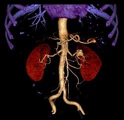 Also click on any other structure which should remain visible (e.g. the kidneys).