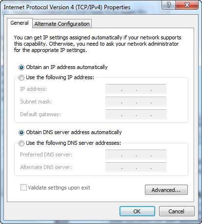 5. Check "Obtain an IP address automatically" and "Obtain DNS