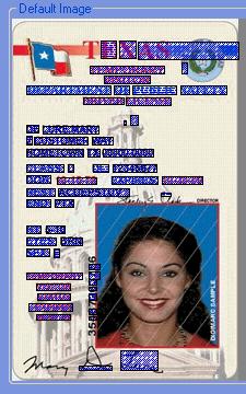 Figure 44: Default Image with Optical Character Recognition The patient's first name and last name are automatically recognized by Capture and entered into the correspoding boxes in the Patient