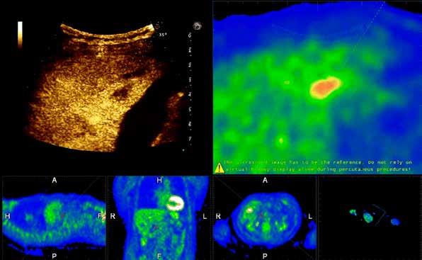 CT, MRI, PET side-by-side with real-time Ultrasound.
