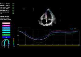 visualization Pulmonary veins Xview
