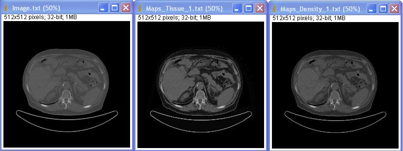 Opening the text file, generated by the ICCT, through ImageJ, its possible to compare the outputs of the ICCT whit the CT images.