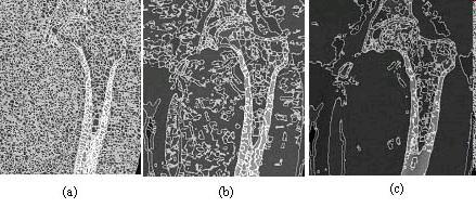 Gray scale intensity Region Growing Watershed Technique CT of different types of bone tissue (femur area) (a) WS over-segmentation (b) WS conditioned by regional