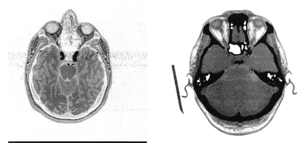 MRI CTI NMI USI Reprinted from Image and Vision