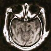 7 MRI Image CT Image DWT