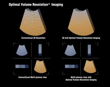 Unlike conventional real-time systems that essentially sacrifice resolution to achieve impressive volume acquisition rates, Optimal Volume Resolution TM delivers superior resolution in