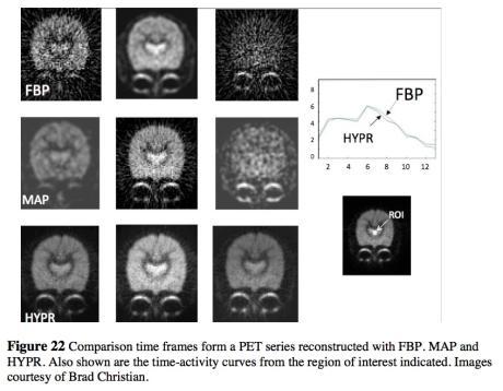 Denoising of Dynamic Pet Series Doppler Ultrasound of Middle Cerebral Artery Through The Skull Christian BT, Vandehey NT,