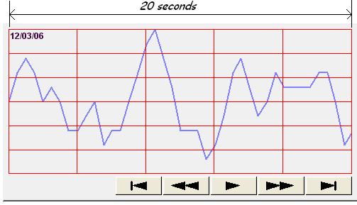 13-94 Dynamic distance between data samples/ Dynamic X axis time range Refresh data automatically Hold control Select [Time] for [X axis time range] and go to [Trend]» [Grid] and enable [Time scale].