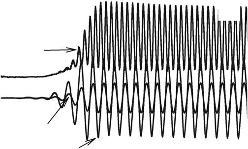 Vortex pattern in the wake of an elastic cylinder for Sg ¼ 0:01 and M ¼ 1.