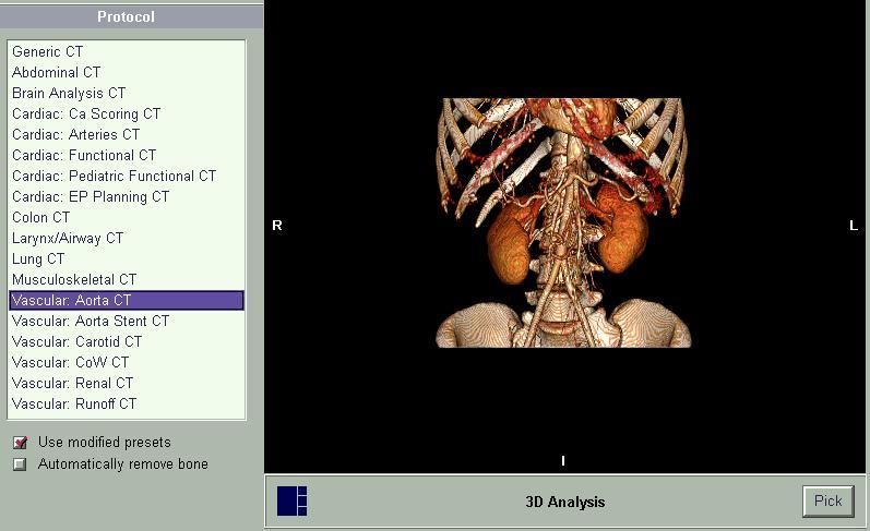 Aorta CTA - Manual Segmentation Select Protocol Vascular Aorta CT. Select 3D Analysis. Click Pick. Select Viewer to process manual segmentation of the aorta.