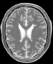 3 db) (g) MR Brain original: Slice number 20 (h) MR Brain reconstructed (PSNR=45.7 db). 4.