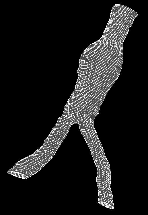 Figure 10 - Marked initial contours in bifurcation segmentation type After detection is started images in this type of the segmentation can be scrolled only