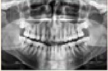 Also previous technique does not handle dental image with scaling factor but our proposed technique works for scaling images too.