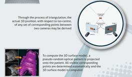 Imaging by VisionRT Advantages: Reproducing patient position from last filmed