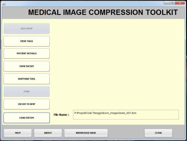 bmp image format to provide as an input for next module. 4.2 Encoder 1. Take the.bmp image from DICOM viewer module as an input to encoder module. 2.