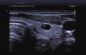 Our recent breakthroughs in lifelike images are displayed on the world s first full HD LED ultrasound monitor, with superior color performance and special filtering that removes unwanted